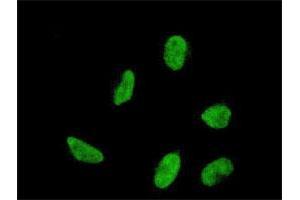 Immunofluorescence of monoclonal antibody to HOXA5 on HeLa cell. (HOXA5 Antikörper  (AA 171-270))