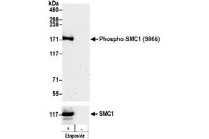 Western Blotting (WB) image for anti-Structural Maintenance of Chromosomes 1A (SMC1A) (pSer966) antibody (ABIN7455211)