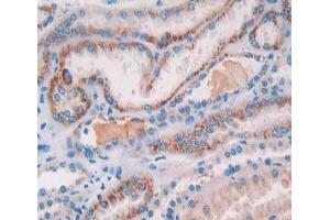 Used in DAB staining on fromalin fixed paraffin- embedded kidney tissue (COL18A1 Antikörper  (AA 1154-1335))