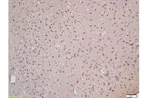 Formalin-fixed and paraffin embedded rat brain labeled with Rabbit Anti-XPB Polyclonal Antibody, Unconjugated (ABIN706031) at 1:200 followed by conjugation to the secondary antibody and DAB staining (ERCC3 Antikörper  (AA 601-700))