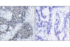 Immunohistochemistry (IHC) image for anti-Eukaryotic Translation Initiation Factor 4E (EIF4E) (AA 168-217), (pSer209) antibody (ABIN1531825)