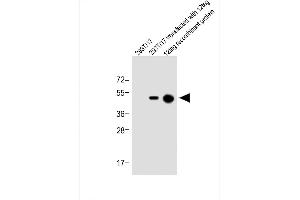 All lanes : Anti-His Tag Antibody at 1:1000 dilution Lane 1: 293T/17 whole cell lysate Lane 2: 293T/17 transfected with 12tag whole cell lysate Lane 3: 12tag recombinant protein Lysates/proteins at 1 μg per lane. (His Tag Antikörper)