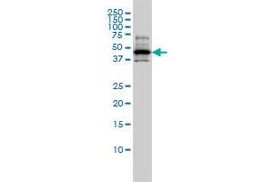 RCC1 monoclonal antibody (M01), clone 2F1 Western Blot analysis of RCC1 expression in A-431 . (RCC1 Antikörper  (AA 312-421))