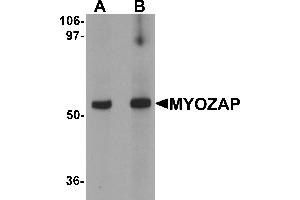 Western blot analysis of MYOZAP in rat kidney tissue lysate with MYOZAP antibody at (A) 1 and (B) 2 µg/mL. (MYZAP Antikörper  (C-Term))