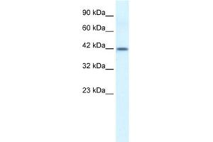 WB Suggested Anti-ESR2 Antibody Titration: 0. (ESR2 Antikörper  (N-Term))