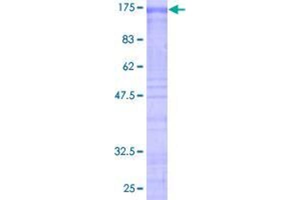 SF3B2 Protein (AA 1-636) (GST tag)