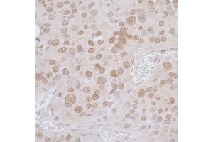 Immunohistochemistry (IHC) image for anti-Thymopoietin (TMPO) (AA 200-250) antibody (ABIN7453438) (Thymopoietin Antikörper  (AA 200-250))