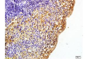 Formalin-fixed and paraffin embedded rat spleen labeled with Rabbit Anti phospho-Pyk2/PTK2B(Tyr402) Polyclonal Antibody, Unconjugated (ABIN745763) at 1:200 followed by conjugation to the secondary antibody and DAB staining