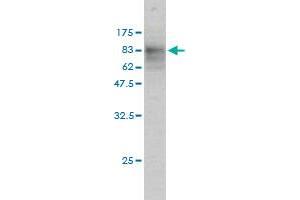 Western Blot detection against Immunogen (74. (SQSTM1 Antikörper  (AA 1-440))