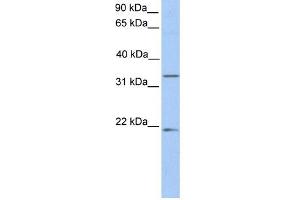FUT6 antibody used at 1 ug/ml to detect target protein. (FUT6 Antikörper  (C-Term))