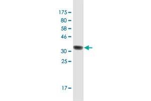 Western Blot detection against Immunogen (36. (RAB3B Antikörper  (AA 120-219))