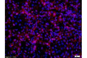 Immunofluorescence (Paraffin-embedded Sections) (IF (p)) image for anti-Microphthalmia-Associated Transcription Factor (MITF) (AA 351-450) antibody (ABIN676373)