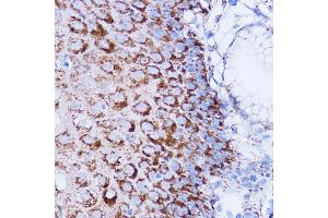 Immunohistochemistry (IHC) image for anti-NADH Dehydrogenase (Ubiquinone) 1 beta Subcomplex, 7, 18kDa (NDUFB7) (AA 1-137) antibody (ABIN6144480)