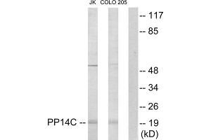 Western blot analysis of extracts from Jurkat cells and COLO205 cells, using PP14C antibody. (PPP1R14C Antikörper  (Internal Region))