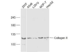 Lane 1: 293T lysates Lane 2: A549 lysates Lane 3: LOVO lysates Lane 4: MCF-7 lysatesLane 5: HepG2 lysates probed with COL2A1 Polyclonal Antibody, Unconjugated  at 1:300 dilution and 4˚C overnight incubation.