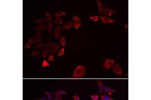 Immunofluorescence analysis of HeLa cells using SKAP2 Polyclonal Antibody (SKAP2 Antikörper)