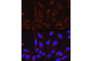 Immunofluorescence analysis of RD cells using CRAT Rabbit pAb (ABIN6131297, ABIN6139003, ABIN6139004 and ABIN6221982) at dilution of 1:50 (40x lens). (CRAT Antikörper  (AA 357-626))