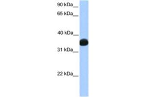 Western Blotting (WB) image for anti-Lactate Dehydrogenase B (LDHB) antibody (ABIN2463156) (LDHB Antikörper)