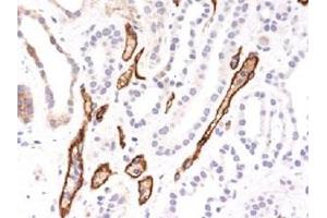 Immunohistochemical staining (Formalin-fixed paraffin-embedded sections) of human kidney transplant. (C4B Antikörper)