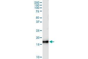 Immunoprecipitation (IP) image for anti-Nudix (Nucleoside Diphosphate Linked Moiety X)-Type Motif 1 (NUDT1) (AA 1-156) antibody (ABIN518070)