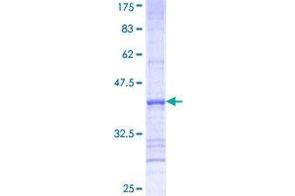 SLC27A3 Protein (AA 635-730) (GST tag)