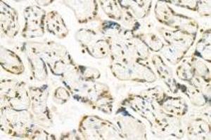 Immunohistochemistry (Paraffin-embedded Sections) (IHC (p)) image for anti-Pinin, Desmosome Associated Protein (PNN) antibody (ABIN7075083)