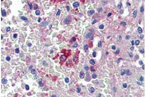 Spleen, Human: Formalin-Fixed, Paraffin-Embedded (FFPE) (HMOX1 Antikörper)