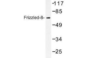 Image no. 1 for anti-Frizzled Family Receptor 8 (FZD8) antibody (ABIN317702) (FZD8 Antikörper)