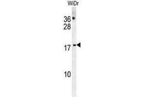 CHCHD2 Antibody (Center) western blot analysis in WiDr cell line lysates (35µg/lane). (CHCHD2 Antikörper  (Middle Region))