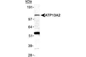 Western blot analysis of ATP13A2 in mouse brain membrane lysate ATP13A2 polyclonal antibody . (ATP13A2 Antikörper  (AA 200-300))