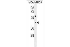 Western blot analysis in MDA-MB435 cell line lysates (35ug/lane). (ABHD9 Antikörper  (C-Term))