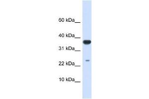 UBE2D2 antibody used at 1 ug/ml to detect target protein.