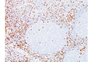 Formalin-fixed, paraffin-embedded human Tonsil stained with CD8 Mouse Monoclonal Antibody (C8/468). (CD8 alpha Antikörper)