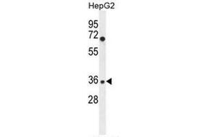 IGHG1 Antibody (Center) western blot analysis in HepG2 cell line lysates (35µg/lane). (IGHG1 Antikörper  (Middle Region))