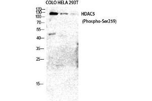 Western Blot (WB) analysis of COLO205 HeLa 293T cells using Phospho-HDAC5/9 (S259/220) Polyclonal Antibody. (HDAC5/9 (pSer220), (pSer259) Antikörper)