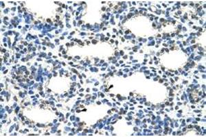 Immunohistochemical staining (Formalin-fixed paraffin-embedded sections) of human lung with ARIH2 polyclonal antibody  at 4-8 ug/mL working concentration. (ARIH2 Antikörper  (N-Term))
