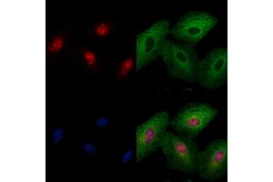 ABIN6259098 and ABIN6274122 staining  cells by IF/ICC. (MAF Antikörper  (C-Term))