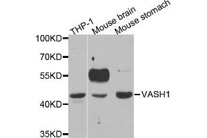 Western blot analysis of extracts of various cell lines, using VASH1 antibody (ABIN5973624) at 1/1000 dilution. (VASH1 Antikörper)
