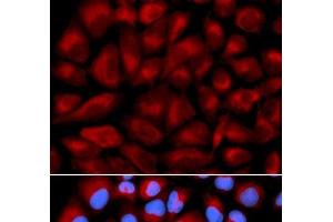 Immunofluorescence analysis of U2OS cells using FANCC Polyclonal Antibody (FANCC Antikörper)