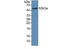 Detection of Recombinant EGFR2, Human using Monoclonal Antibody to Receptor Tyrosine Protein Kinase erbB-2 (ErbB2) (ErbB2/Her2 Antikörper  (AA 376-578))
