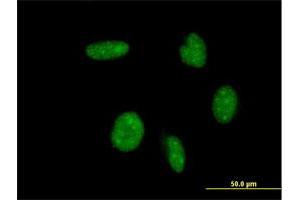 Immunofluorescence of monoclonal antibody to ATOH1 on HeLa cell. (ATOH1 Antikörper  (AA 266-354))