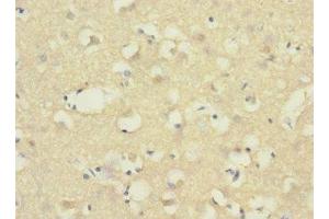 Immunohistochemistry of paraffin-embedded human brain tissue using ABIN7143380 at dilution of 1:100 (ADGRB1 Antikörper  (AA 60-350))