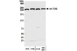 Western Blotting (WB) image for anti-Cytoskeleton Associated Protein 5 (CKAP5) (AA 1982-2032) antibody (ABIN7450111) (CKAP5 Antikörper  (AA 1982-2032))