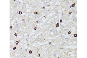 Immunohistochemistry of paraffin-embedded Rat brain using MIP Polyclonal Antibody at dilution of 1:100 (40x lens). (Mip Antikörper)