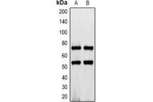 Western blot analysis of CD127 expression in K562 (A), rat heart (B) whole cell lysates. (IL7R Antikörper  (C-Term))