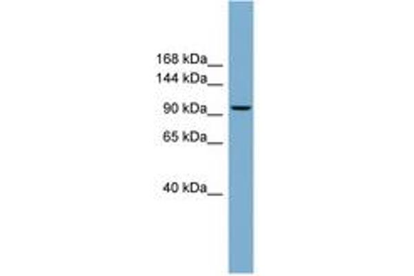 PPP1R3A 抗体  (N-Term)