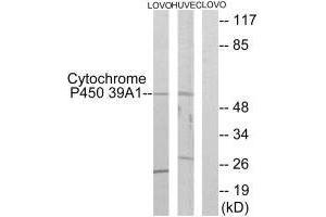 Western blot analysis of extracts from LOVO cells and HUVEC cells, using Cytochrome P450 39A1 antibody. (CYP39A1 Antikörper)