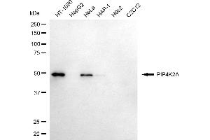 Western blotting analysis using PIP4K2A antibody (ABIN7799795).