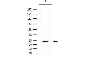anti-Ribosomal Protein L10 (RPL10) (N-Term) antibody