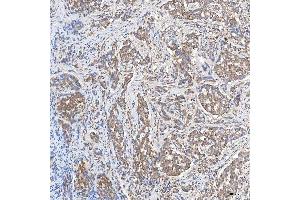 IHC analysis of SLC20A1 using anti-SLC20A1 antibody (ABIN7602463).